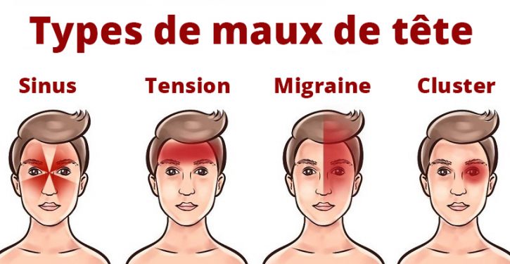Les différents types de céphalées
